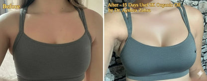 Real 15-day results to increase breast size naturally using SK Organic Oil by Dr. Ayesha Zahra.